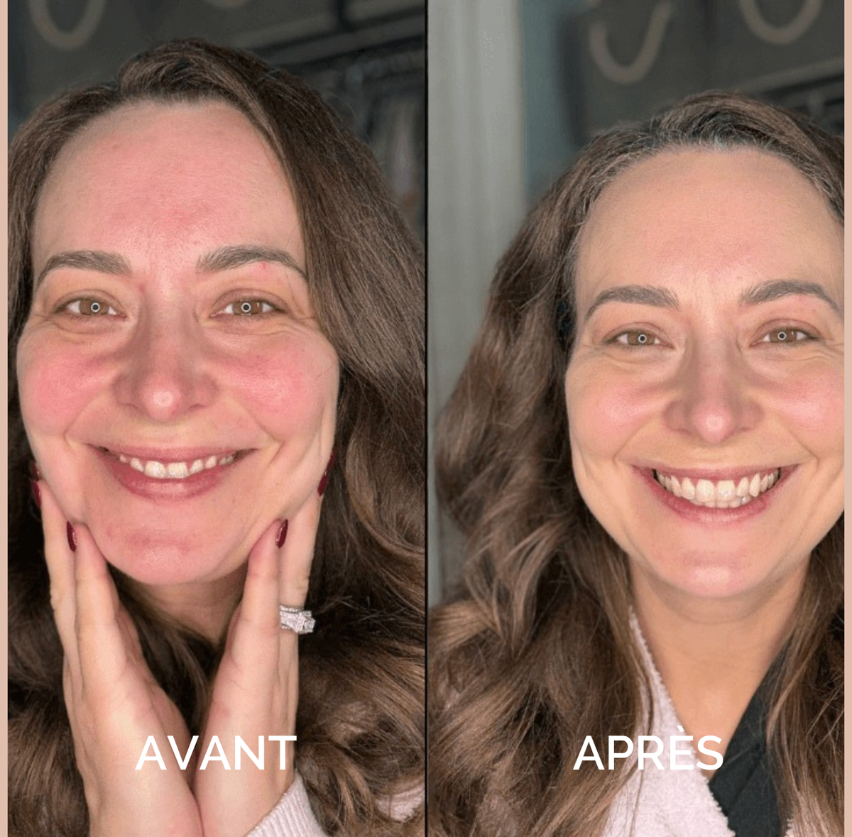 Fond de teint Elroel™ Bio-Adapt